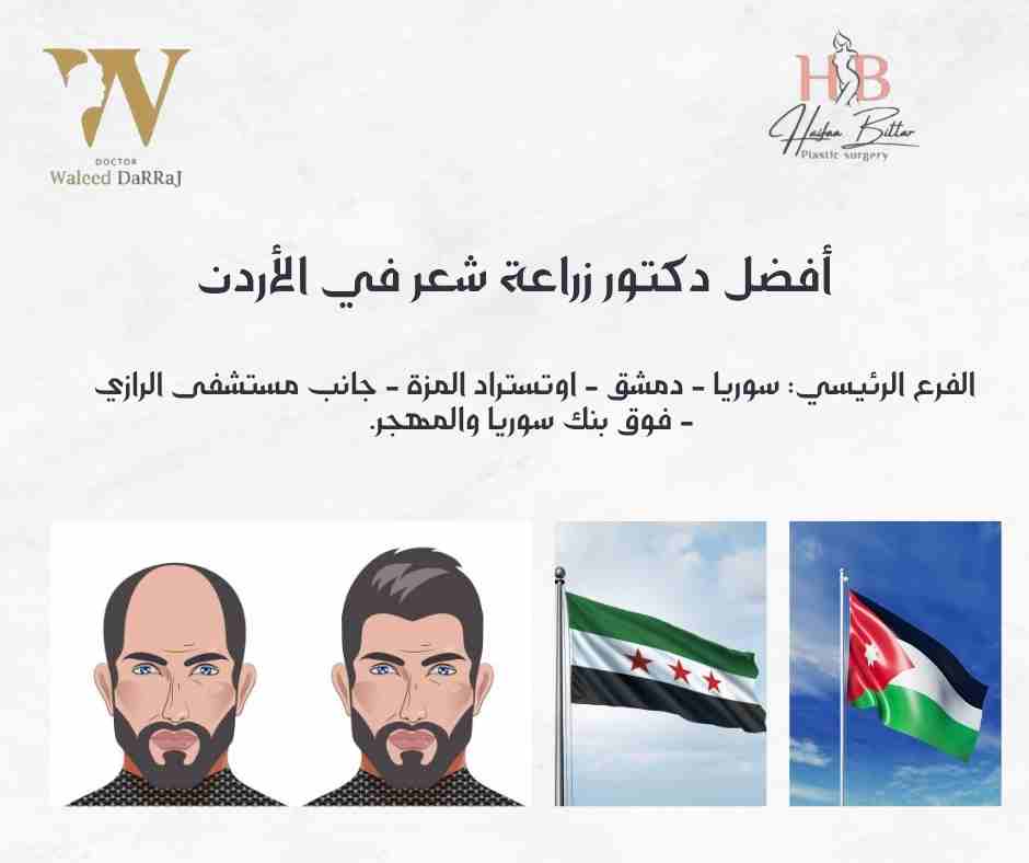 أفضل دكتور زراعة شعر في الأردن