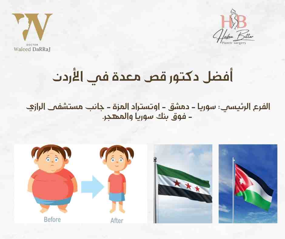 أفضل دكتور قص معدة في الأردن