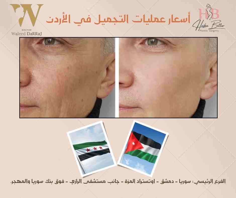 أسعار عمليات التجميل في الأردن 