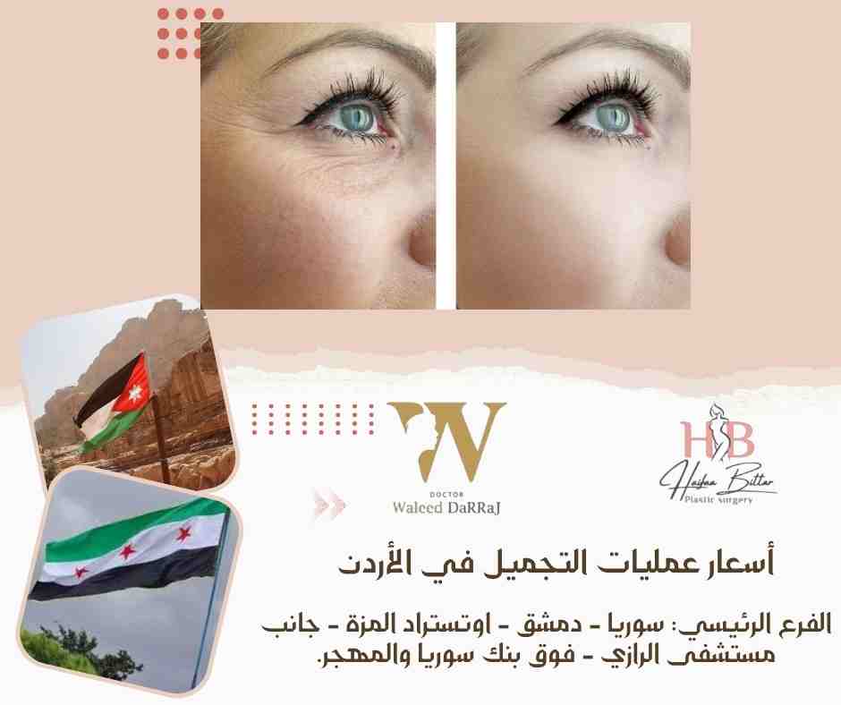 أسعار عمليات التجميل في الأردن 