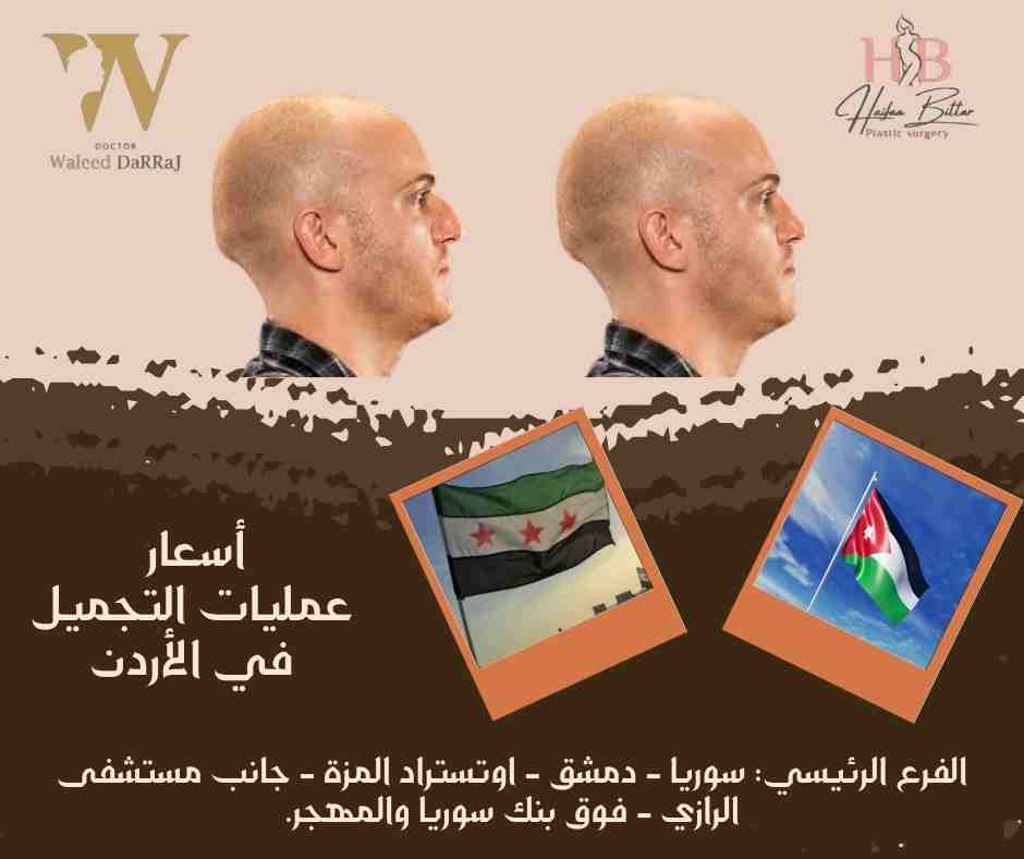 أسعار عمليات التجميل في الأردن 