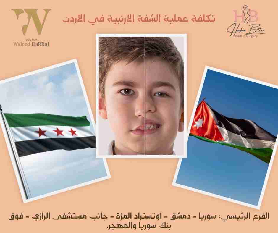 تكلفة عملية الشفة الارنبية في الاردن