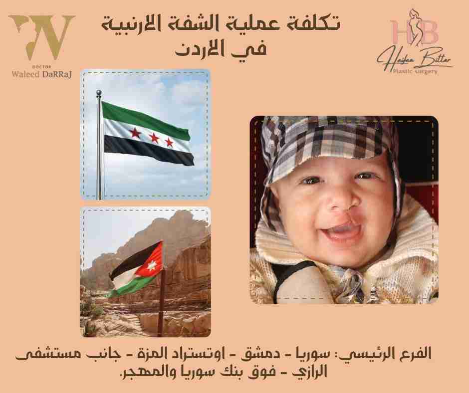 تكلفة عملية الشفة الارنبية في الاردن