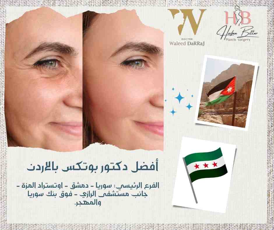 أفضل دكتور بوتكس بالاردن