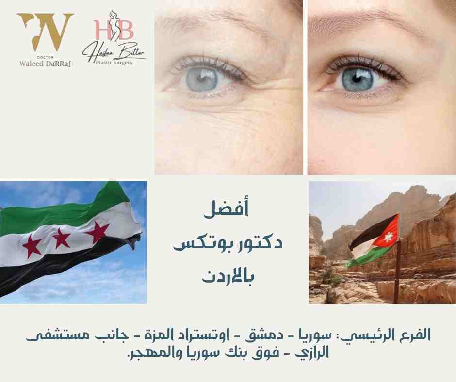 أفضل دكتور بوتكس بالاردن