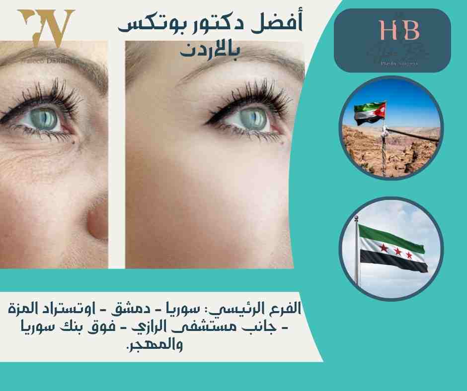 أفضل دكتور بوتكس بالاردن