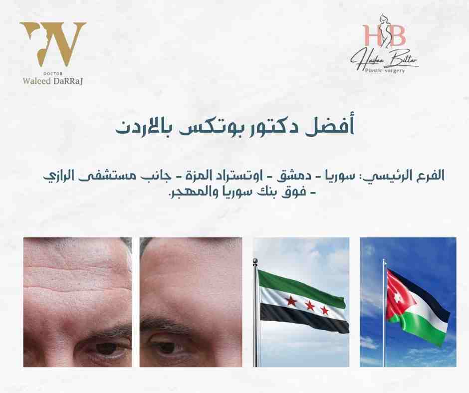 أفضل دكتور بوتكس بالاردن