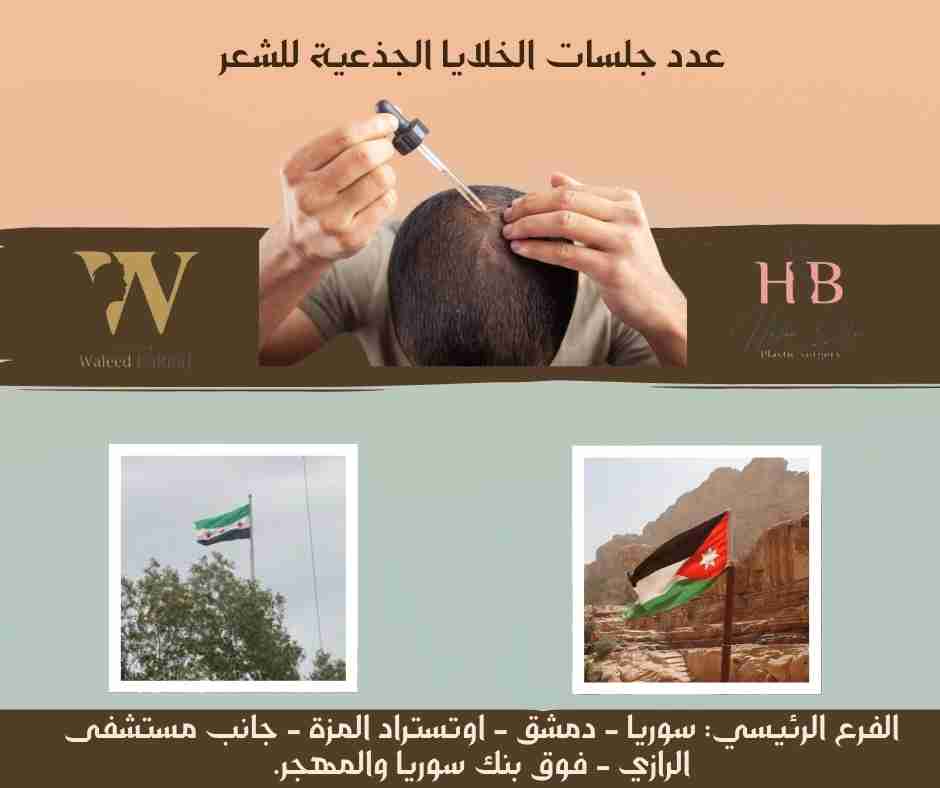 عدد جلسات الخلايا الجذعية للشعر