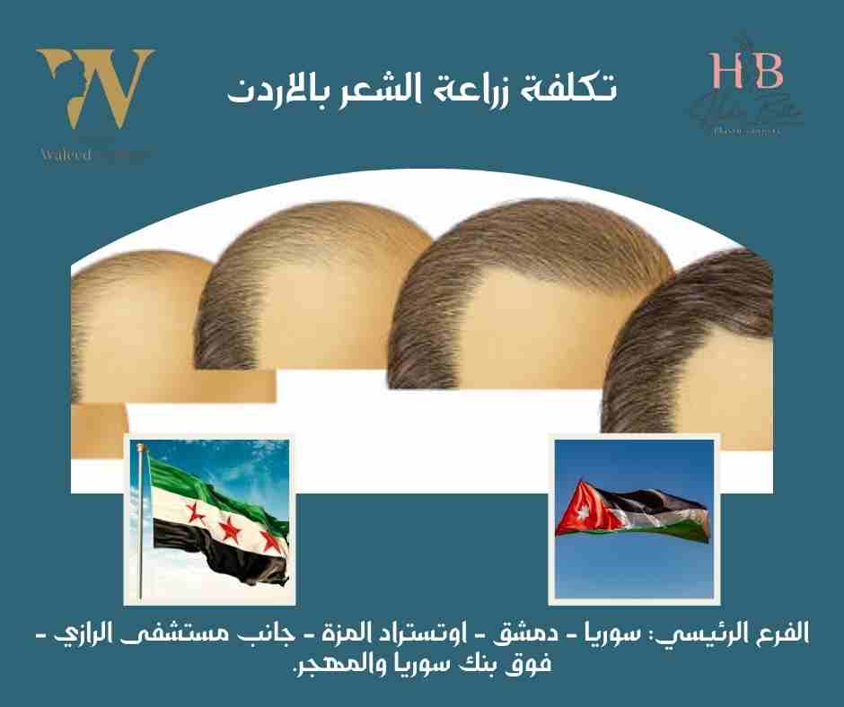 تكلفة زراعة الشعر بالاردن