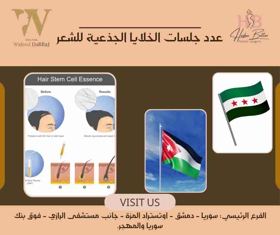 عدد جلسات الخلايا الجذعية للشعر