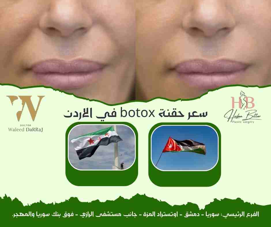 سعر حقنة botox في الاردن