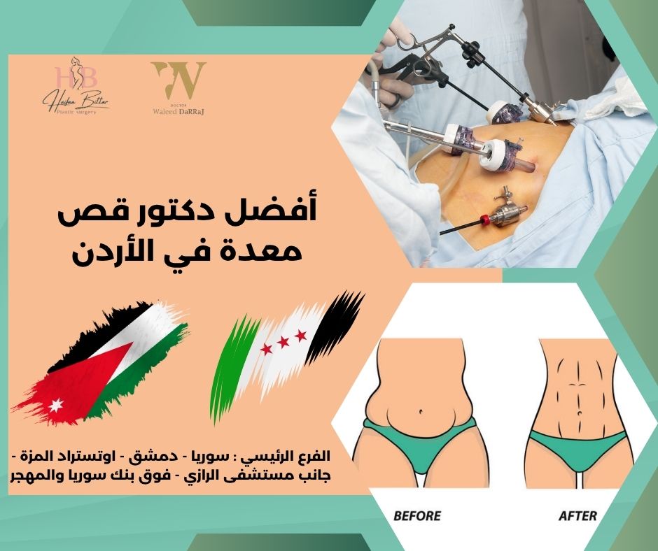 دكتور قص معدة في الاردن