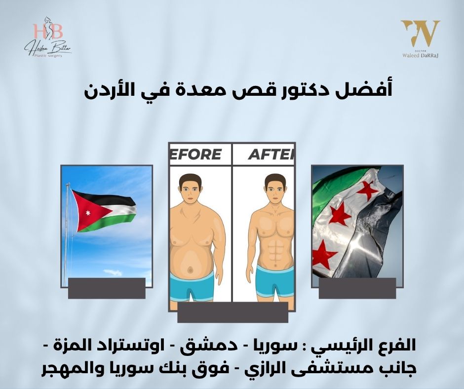 دكتور قص المعده في الاردن