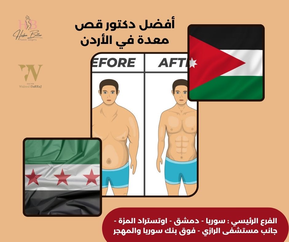 أفضل دكتور قص معدة في الأردن