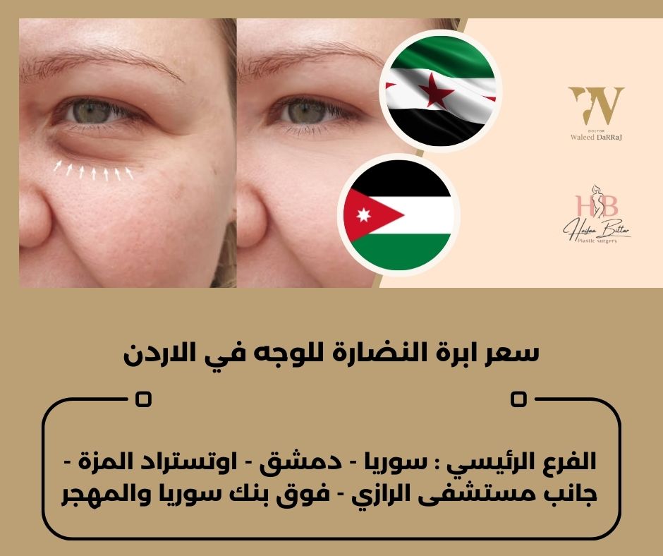 سعر ابرة النضارة للوجه في الاردن