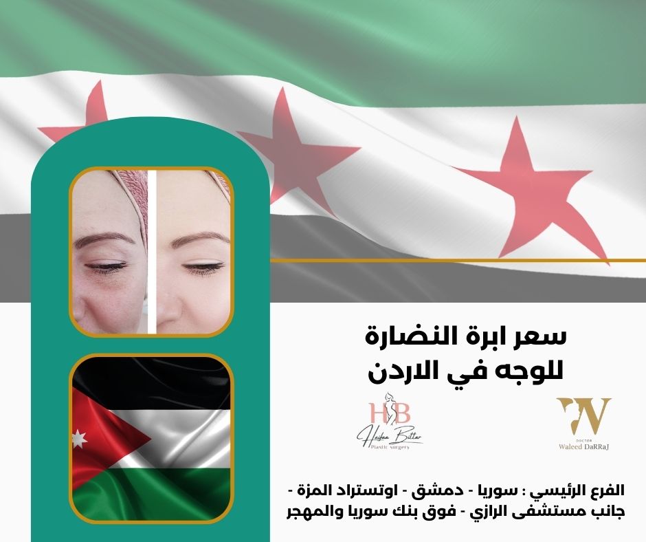 سعر ابرة النضارة للوجة في الأردن