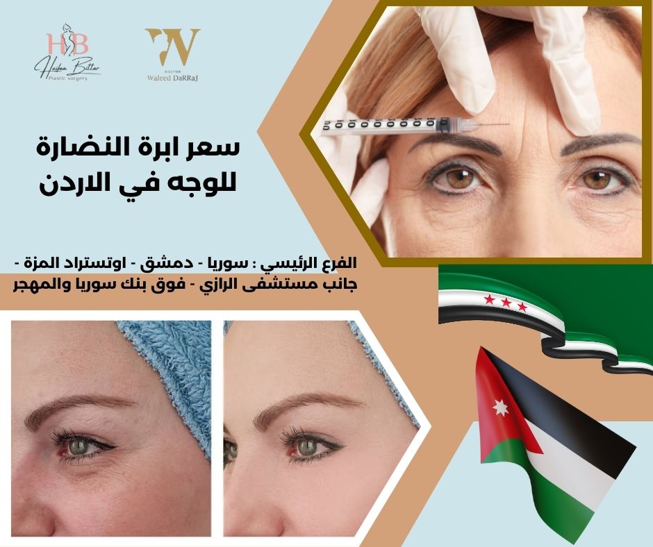 أسعار ابر النضارة في الاردن