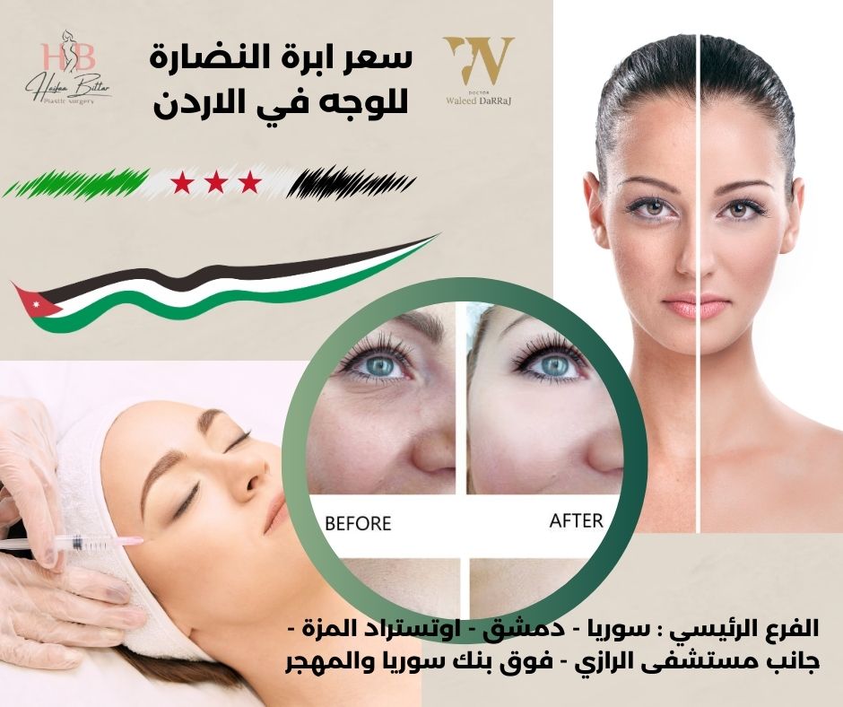 أسعار ابر النضارة في الاردن