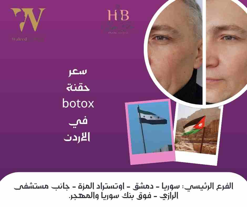 سعر حقنة botox في الاردن