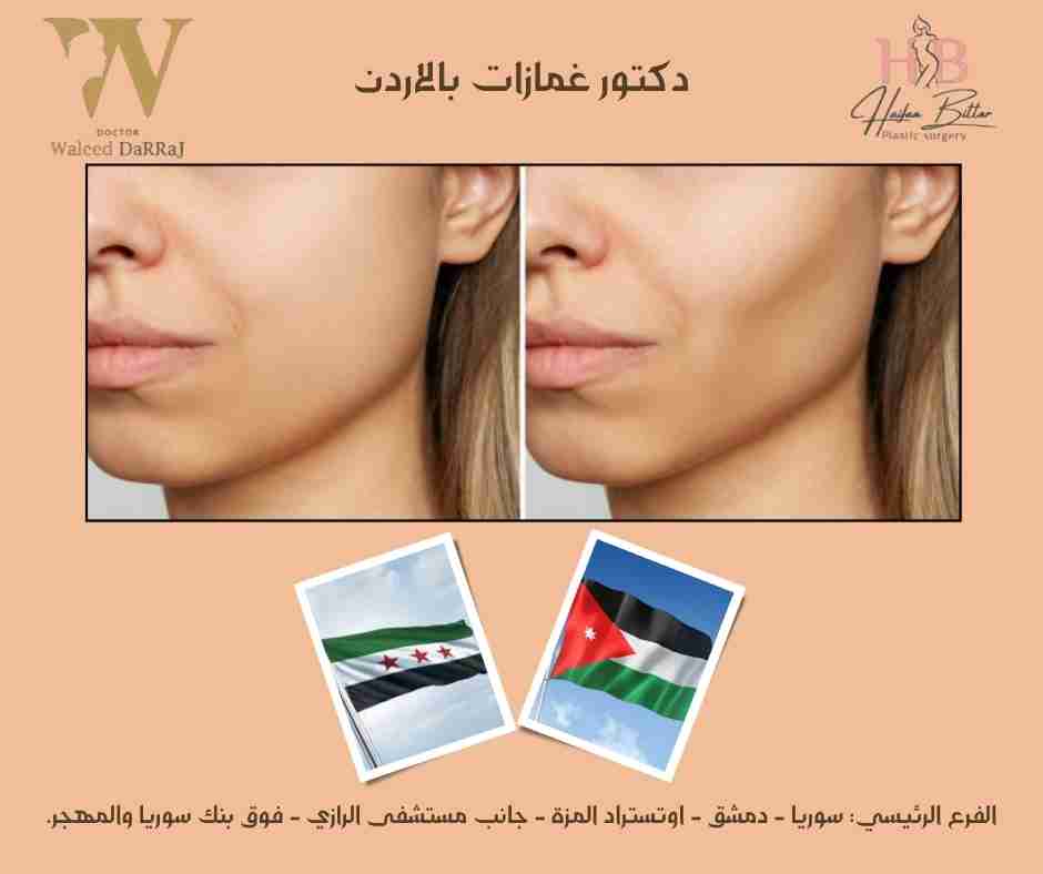 دكتور غمازات بالاردن