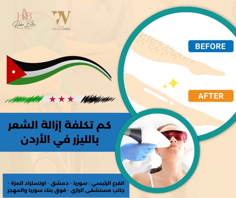 كم تكلفة إزالة الشعر بالليزر في الأردن