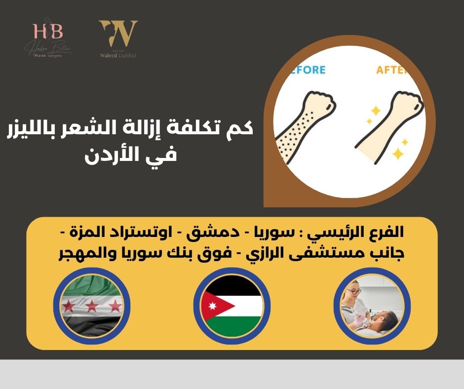 أفضل مراكز إزالة الشعر بالليزر في الأردن