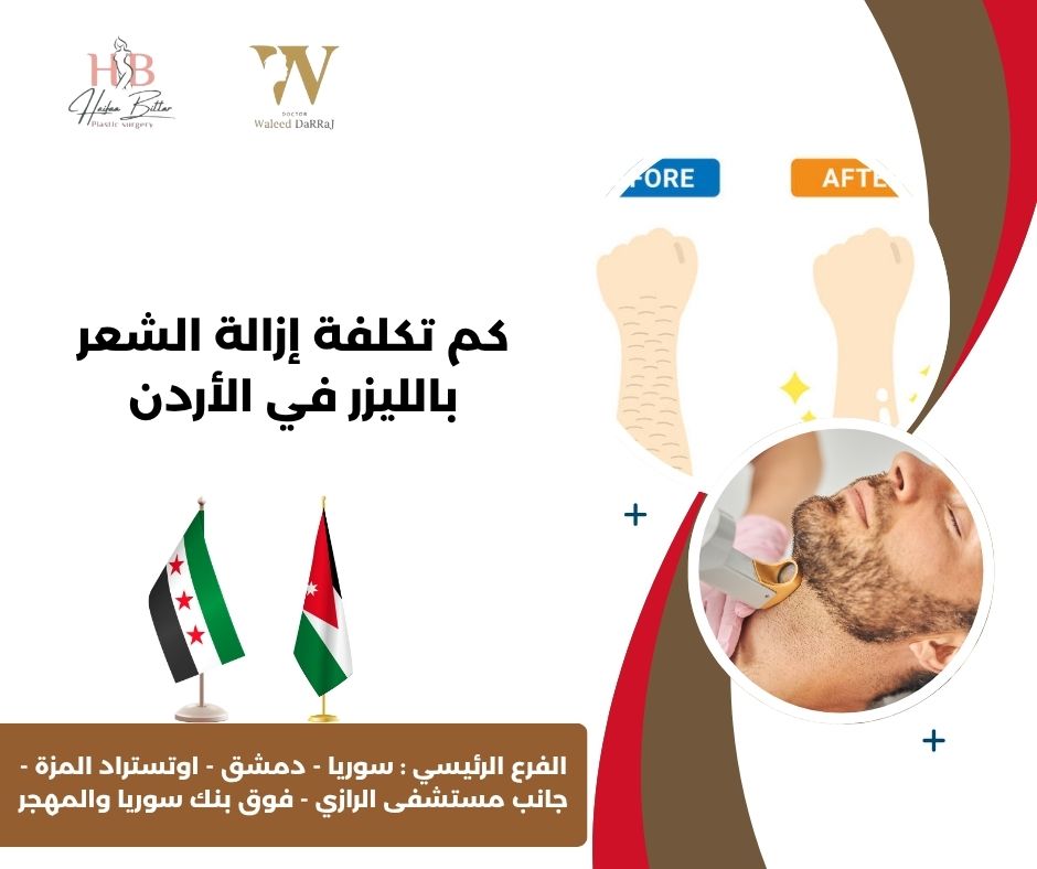 ازالة الشعر بالليزر في الاردن