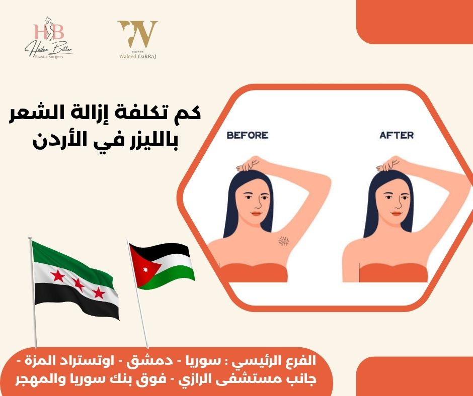 كم تكلفة إزالة الشعر بالليزر في الأردن