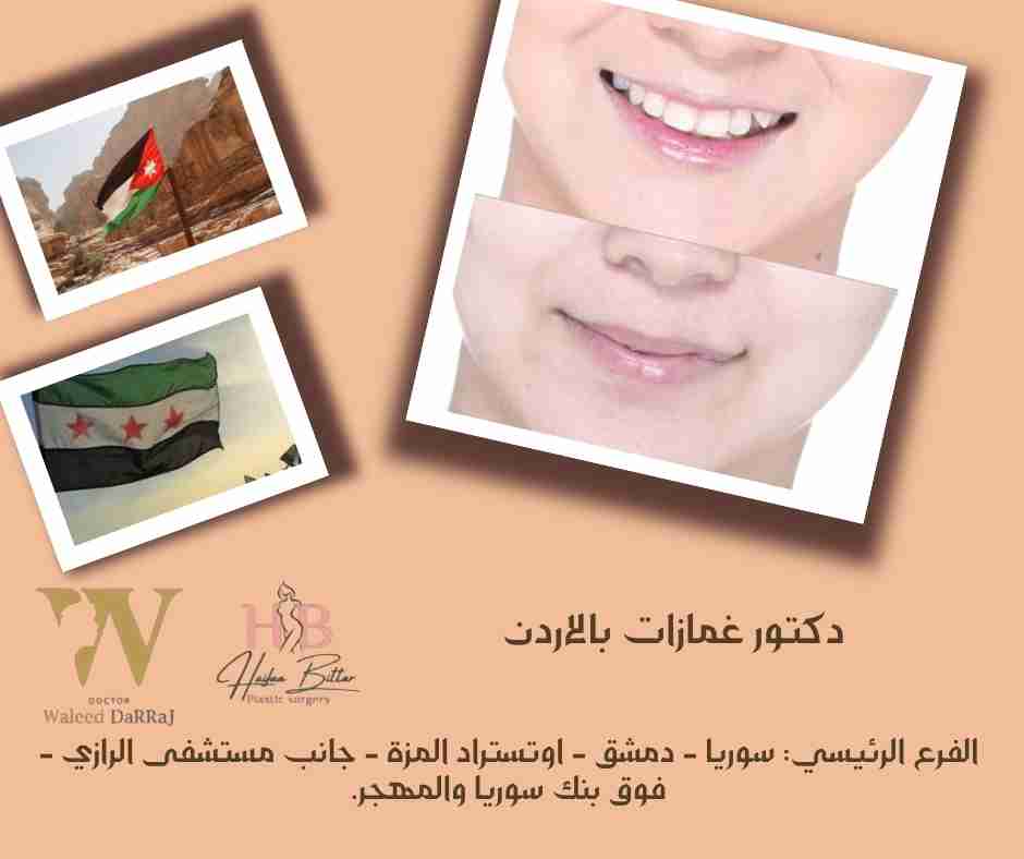 دكتور غمازات بالاردن