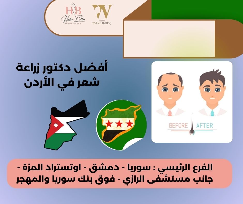 افضل مركز زراعة شعر في الاردن