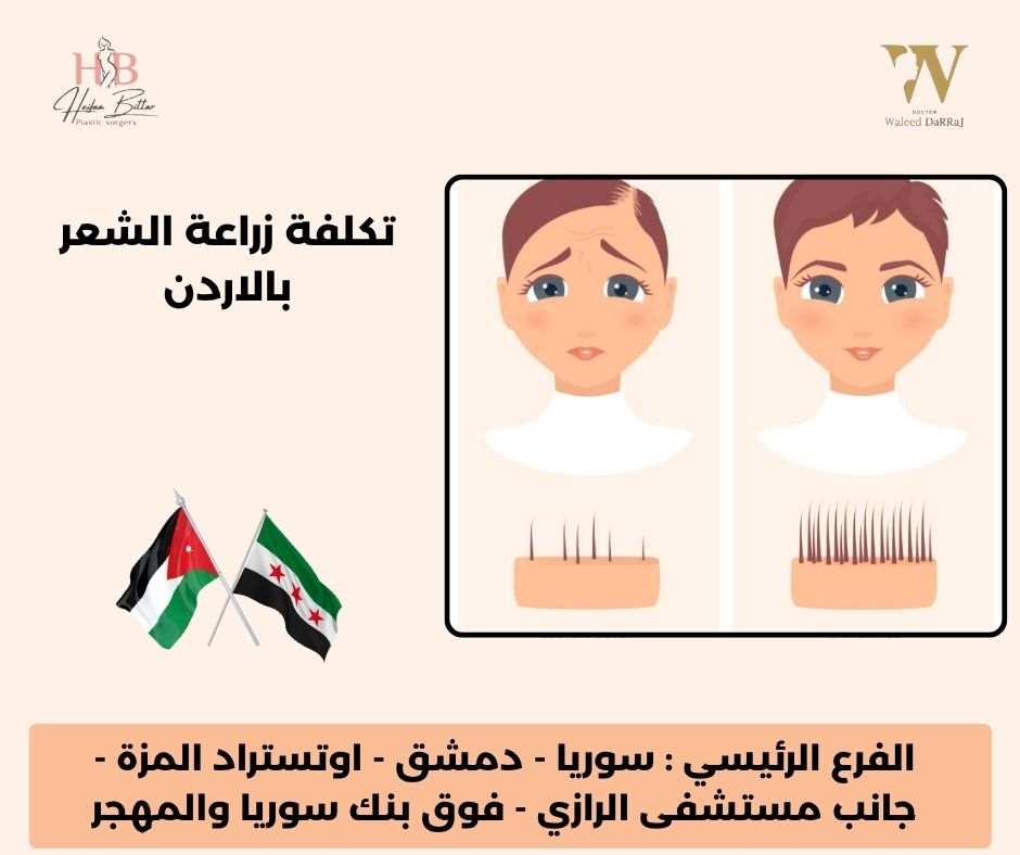 مراكز زراعة الشعر في عمان