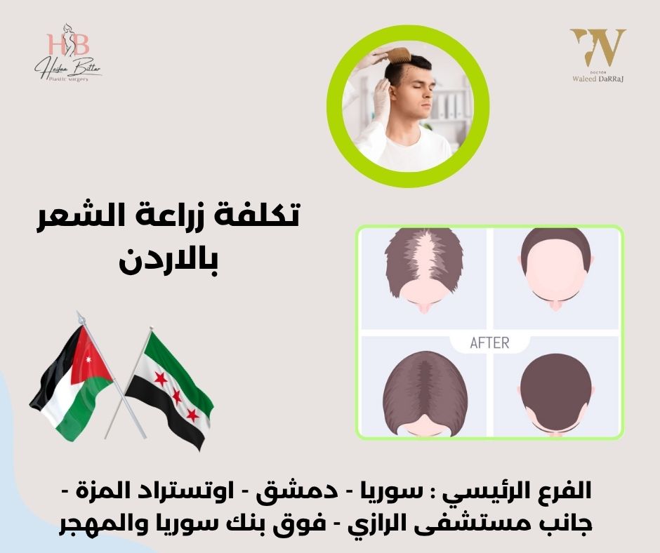المركز التركي الأردني لزراعة الشعر