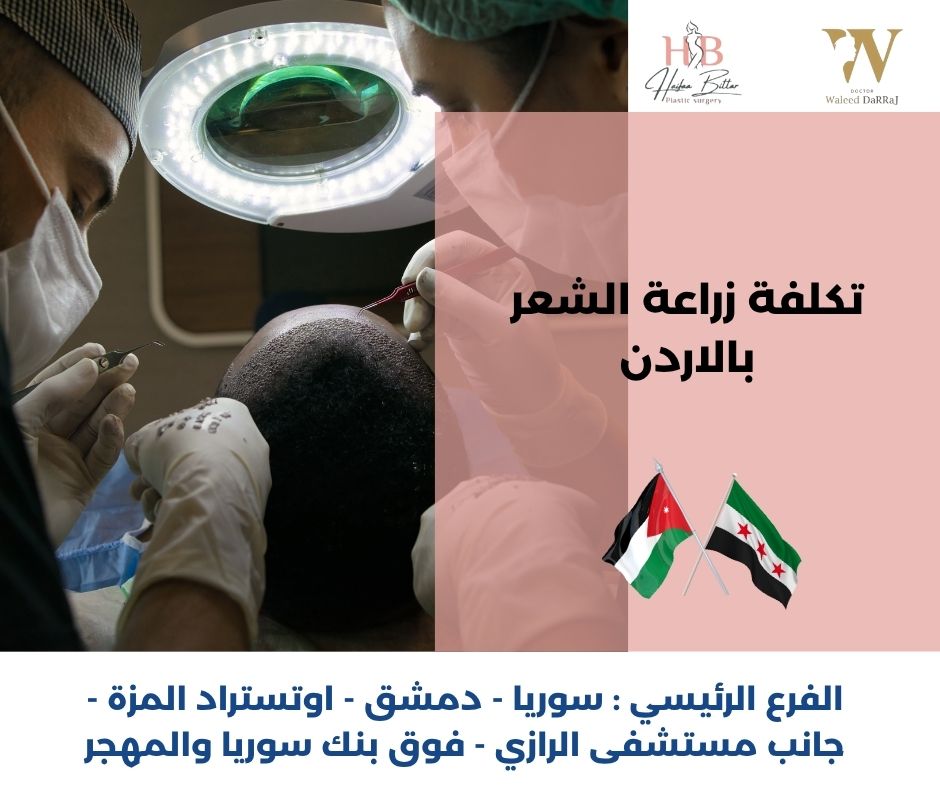 أفضل دكتور زراعة شعر في الأردن