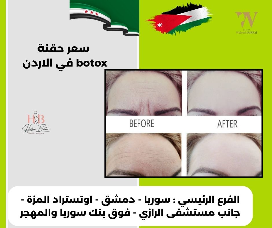 اسعار حقن البوتكس في الاردن