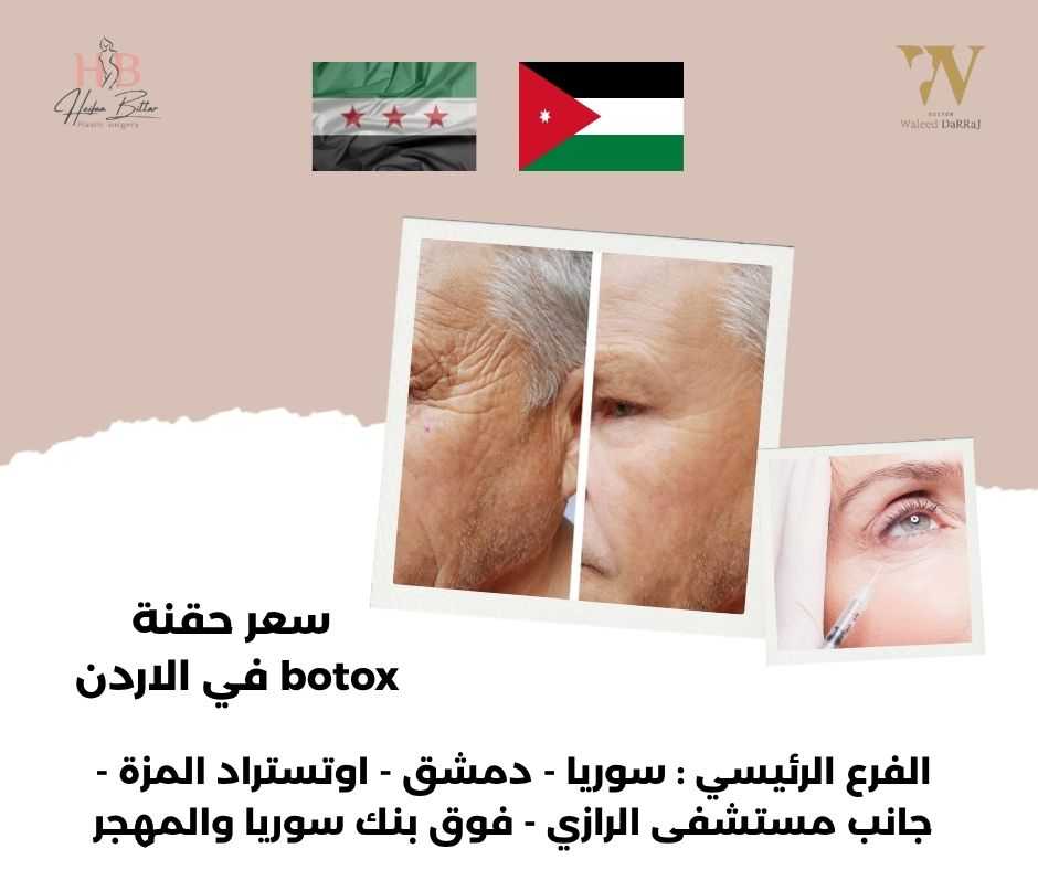 سعر إبرة الفيلر في الأردن