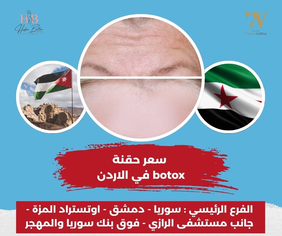 اسعار حقن البوتكس في الأردن