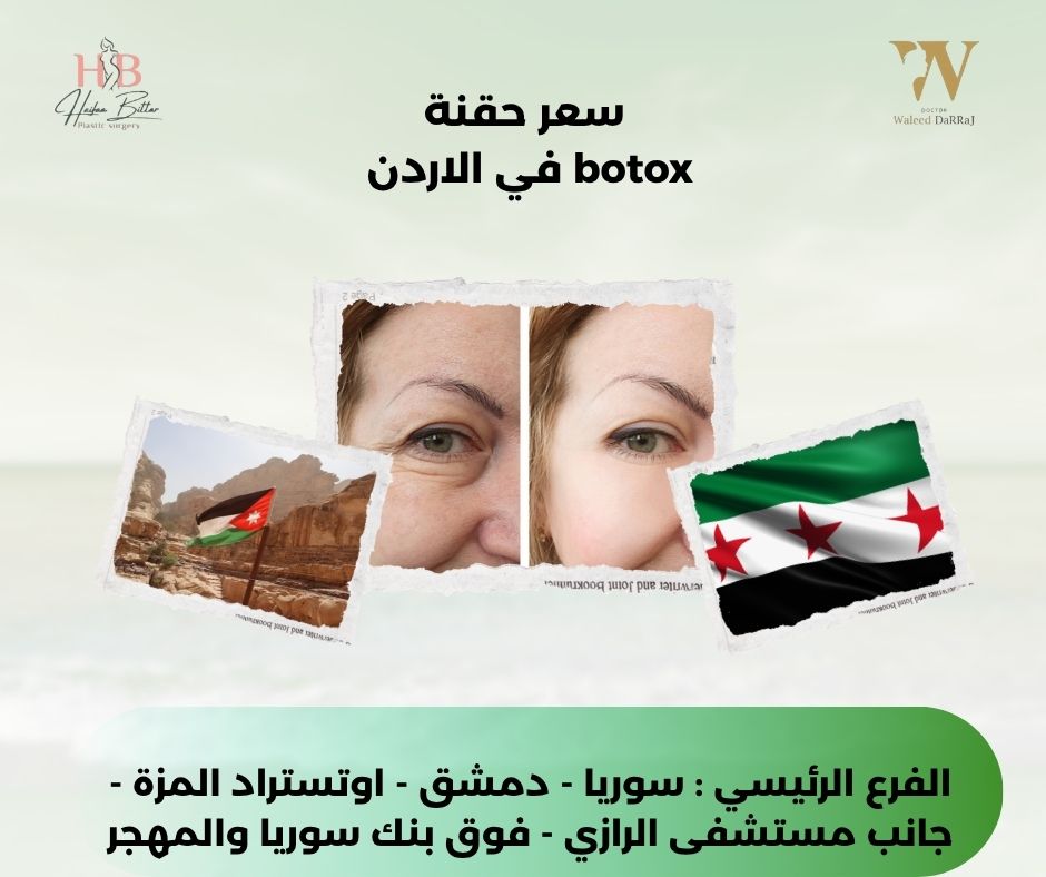 سعر حقنة botox المعدة في الاردن