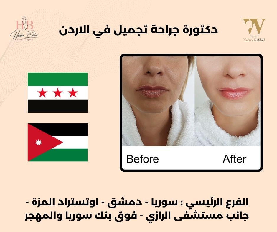 دكتورة جراحة تجميل في الاردن