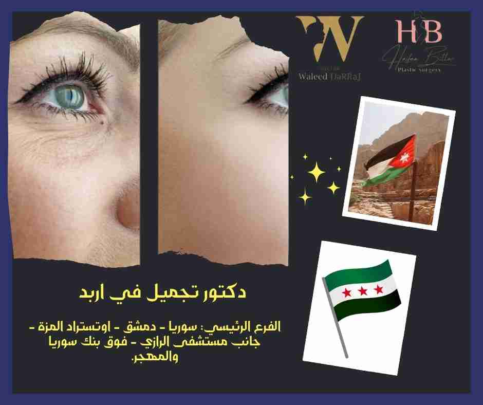 دكتور تجميل في اربد