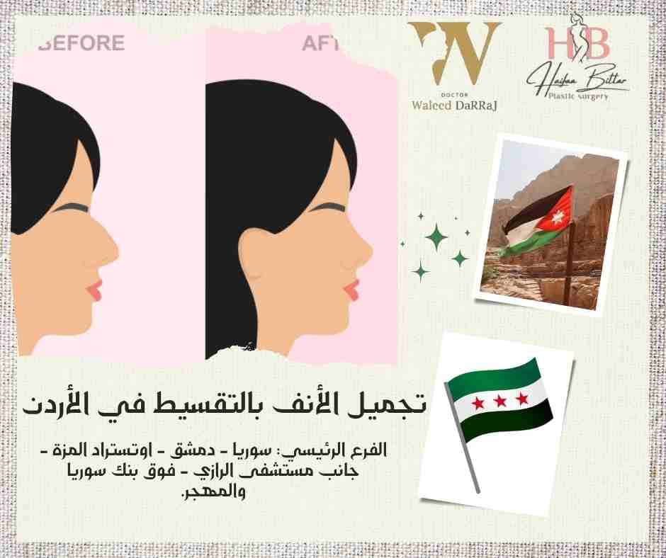تجميل الأنف بالتقسيط في الأردن
