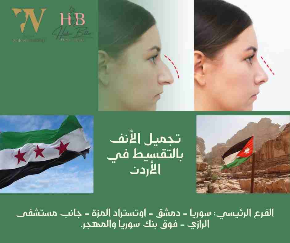 تجميل الأنف بالتقسيط في الأردن