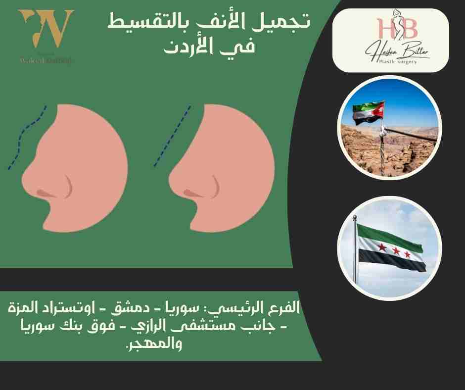 تجميل الأنف بالتقسيط في الأردن