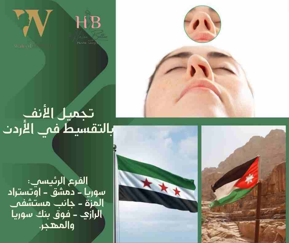 تجميل الأنف بالتقسيط في الأردن