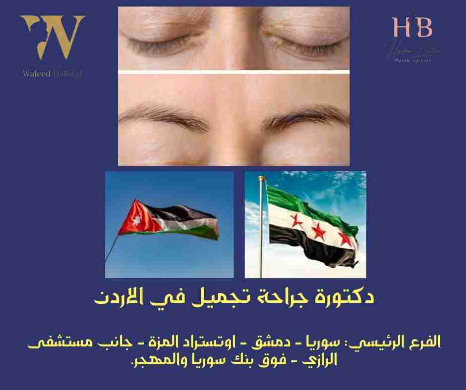 دكتورة جراحة تجميل في الاردن