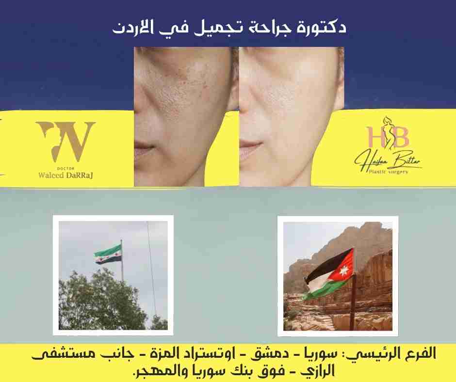 دكتورة جراحة تجميل في الاردن