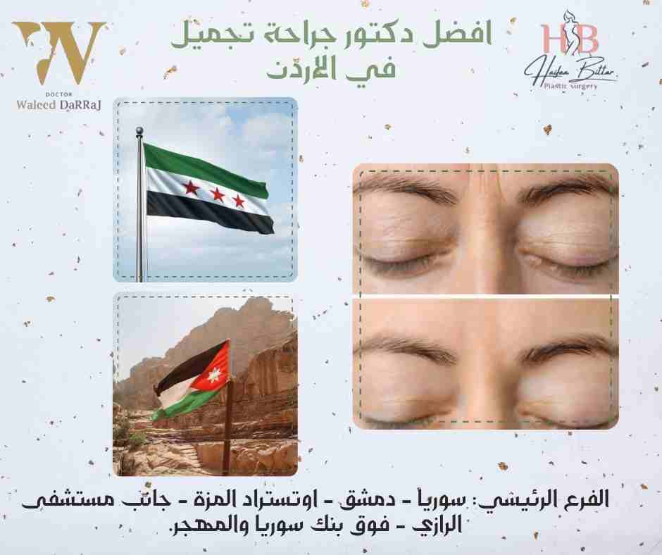 افضل دكتور جراحة تجميل في الاردن