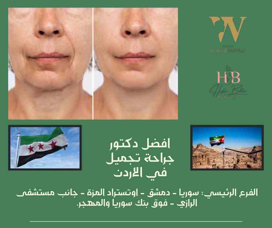 افضل دكتور جراحة تجميل في الاردن