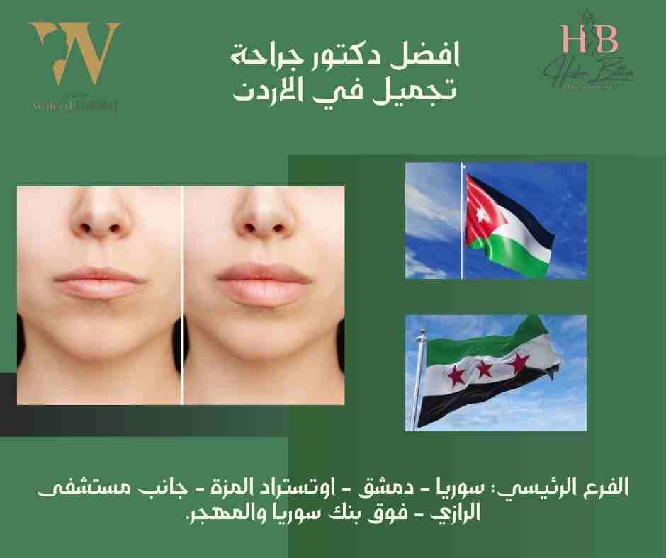 افضل دكتور جراحة تجميل في الاردن