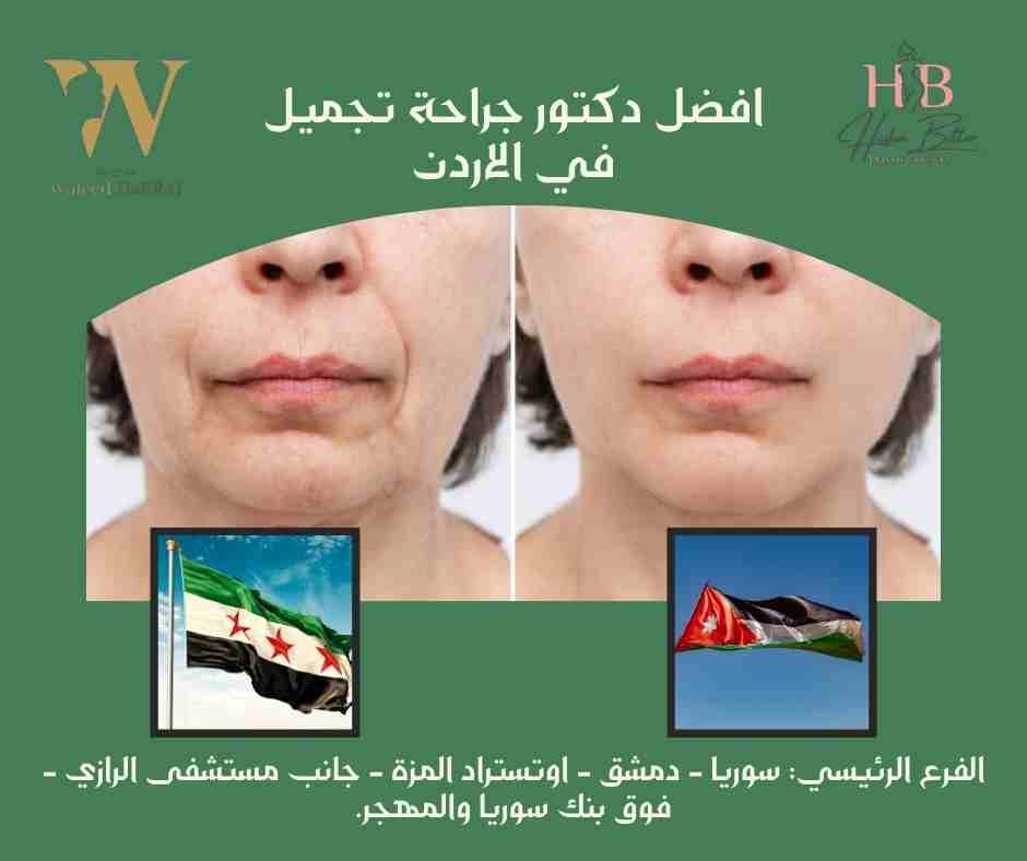افضل دكتور جراحة تجميل في الاردن