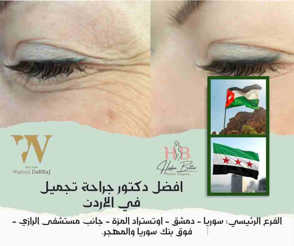 افضل دكتور جراحة تجميل في الاردن